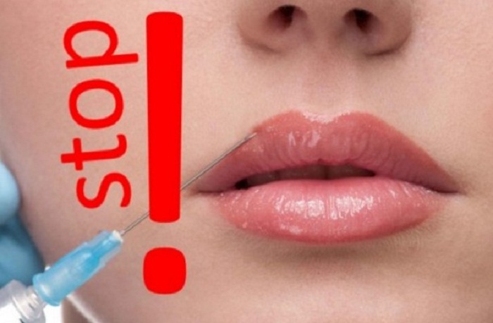 увеличение губ гиалуроновой кислотой противопоказания
