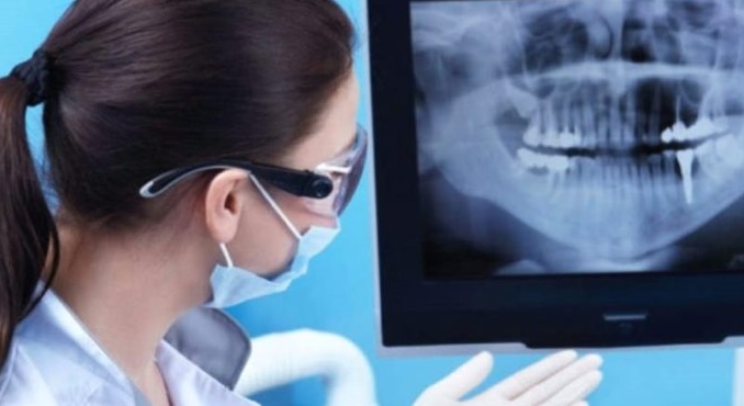 рентген зубов на мониторе